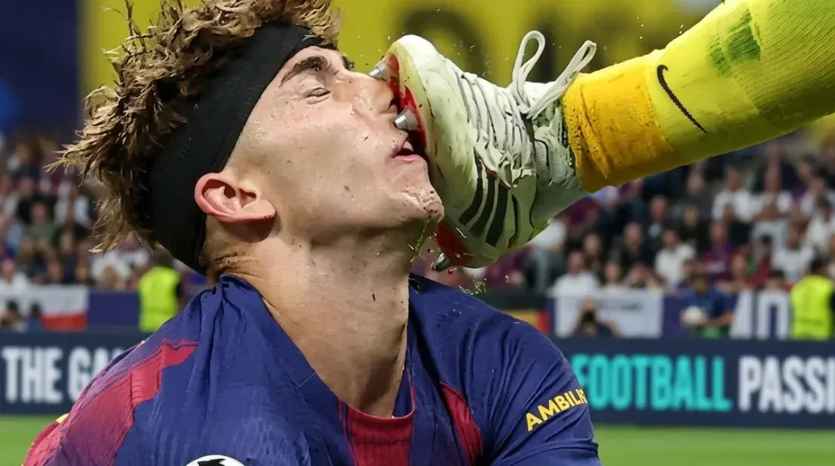 إصابة قوية في وجه لاعب برشلونة خلال مباراة أمام أتلتيكو مدريد